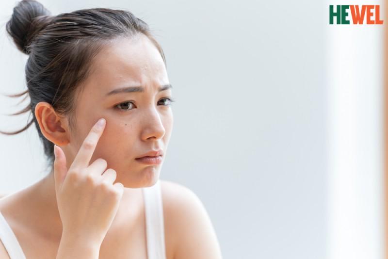 Da mặt sần sùi: Nguyên nhân, dấu hiệu nhận biết và cách khắc phục